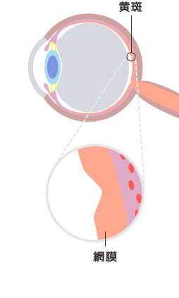 正常な目のイメージ図