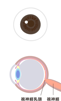 正常な目のイメージ図